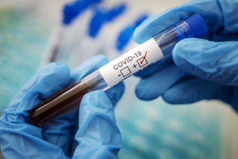 Рынок тестов на коронавирус заняли компании, аффилированные с высшими чиновниками и олигархами